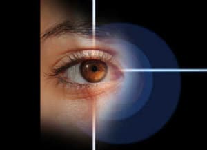 cataract treatment in greenfield ma